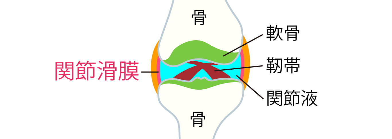 関節の図